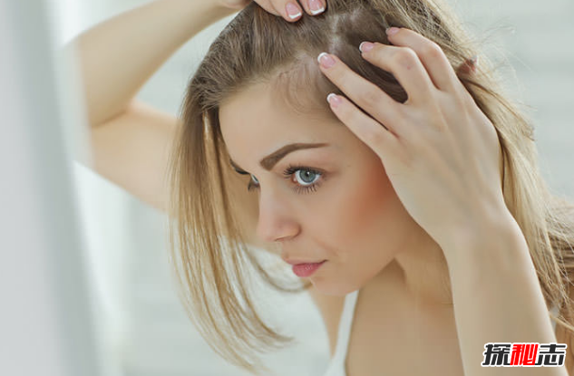 脱发是癌症的征兆?头发脱落的10大改善办法