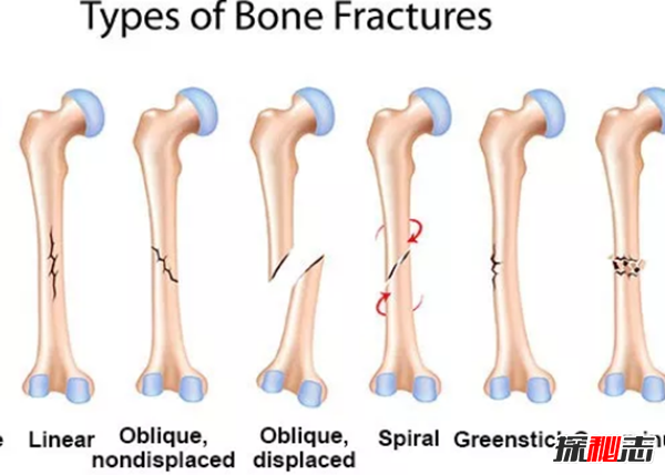 人骨为什么那么可怕?人体骨骼的十大疯狂事实