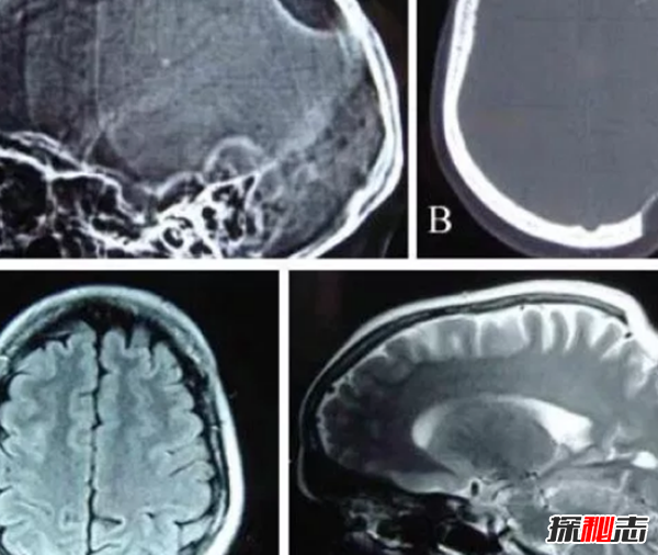 人骨为什么那么可怕?人体骨骼的十大疯狂事实