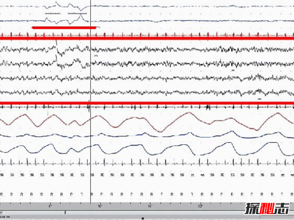 做清醒梦都是些什么人?关于清醒梦的12个离奇事实