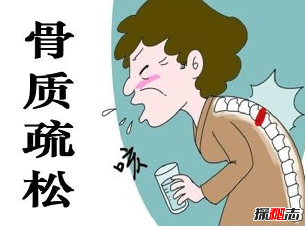 担心!20个残忍的遗传真相,父母会遗传给孩子的多种疾病