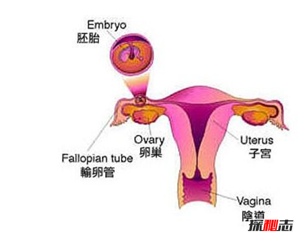 葡萄胎是什么?葡萄胎是什么原因造成的(六个因素)