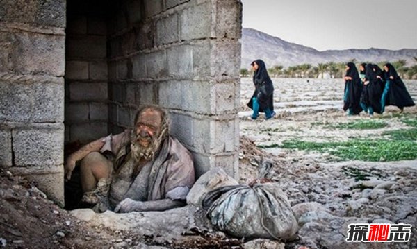 震撼世界的十大怪人 吃飞机/60年不洗澡的人你见过吗?