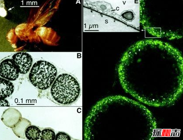 细菌最大有多大?世界上最大的细菌(附图片)
