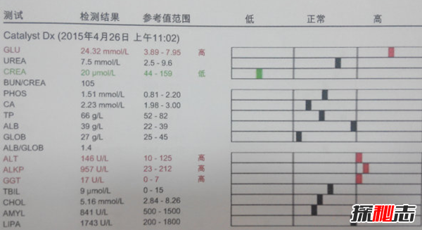 什么是库兴氏综合症?分泌过量糖皮质激素所致的疾病