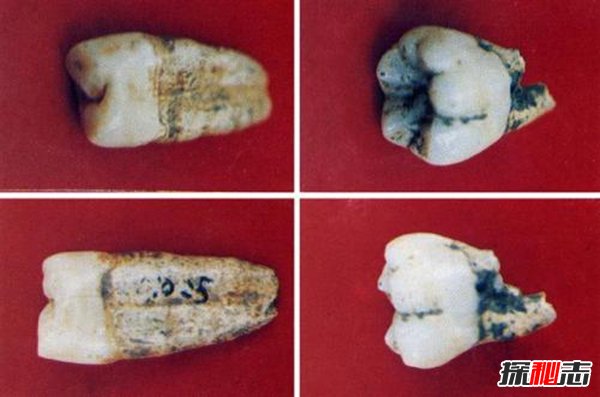 人类未公开的十大史前文明,1.3万年前就有牙医存在了